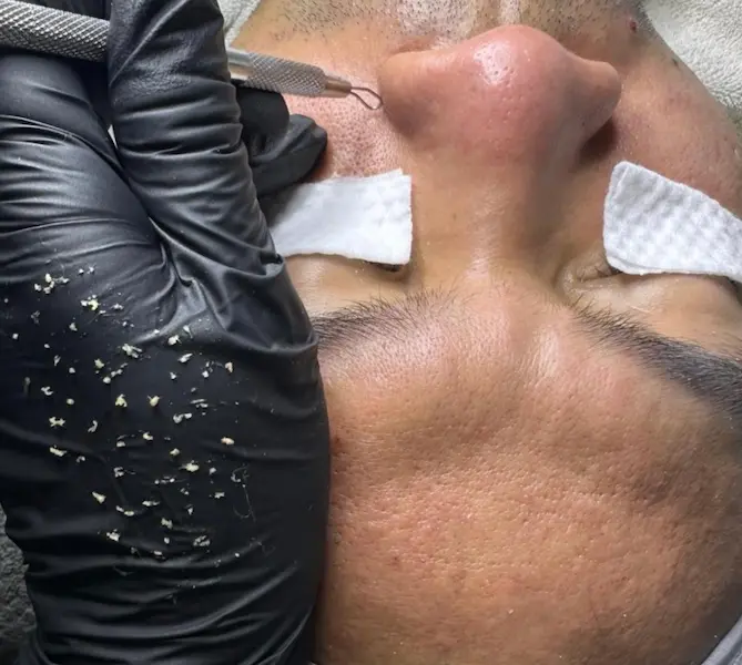Astic Skin Solutions