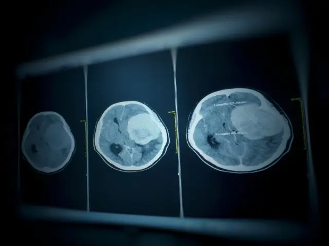 Dr Yeo Tong Hong 杨宗鸿 - Paediatrics & Neuroscience Centre