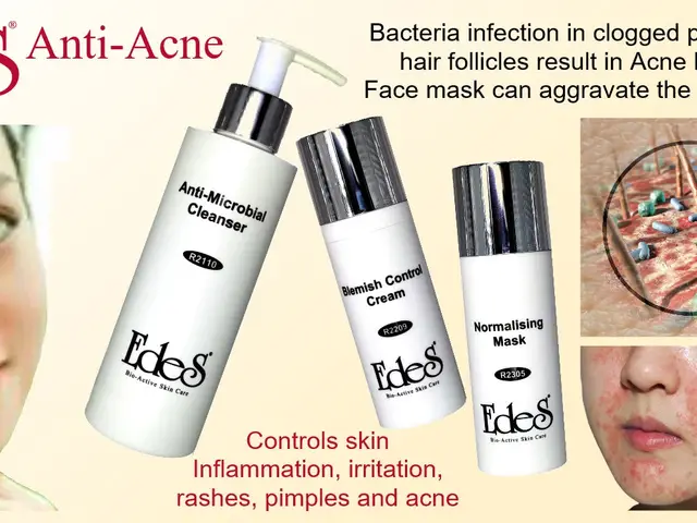 EdeS Spa