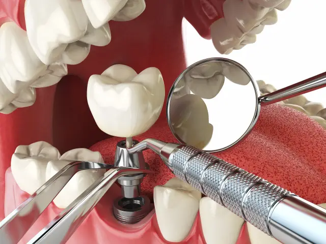 Elite Dental Group
