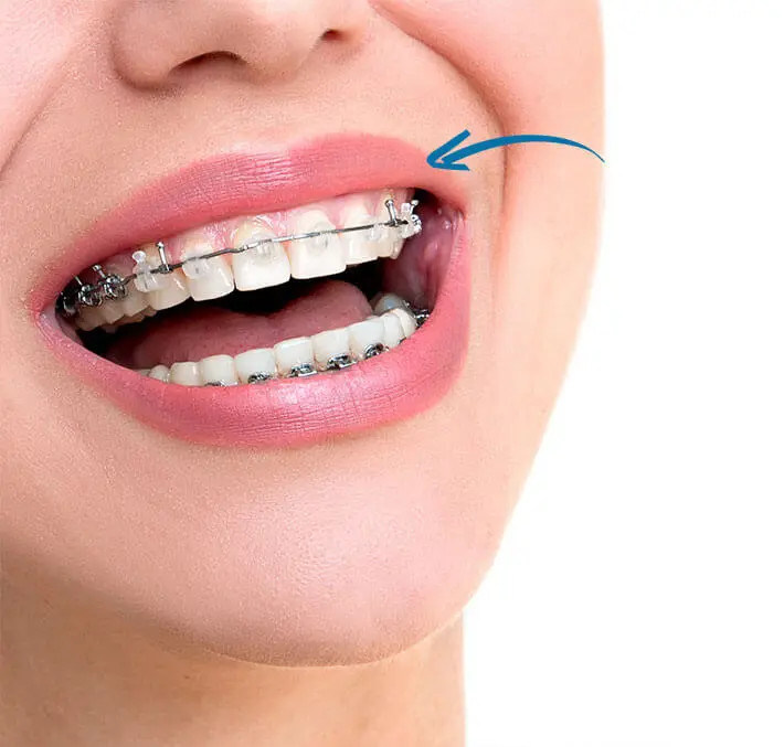 @Just Braces.Dental Centre