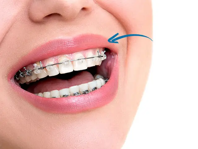 @Just Braces.Dental Centre